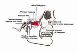 Temporomandibular Joint Anatomy Dysfunction Tmj Zone Articular Posterior Disc Intermediate Pad Part Anterior Bands Cranial Dental sketch template