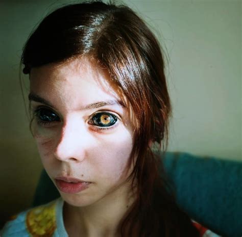 polish girl goes blind after tattooing her eyes black demotix