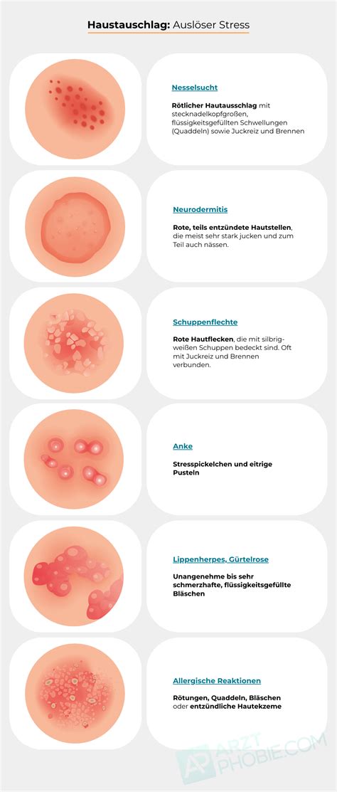 hautausschlag durch stress  tun pickel durch stress
