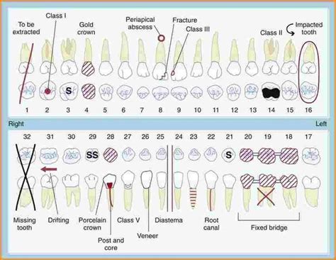 dental charting dental charting dental hygiene school dental