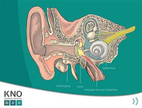vocht achter het trommelvlies kno medisch centrum