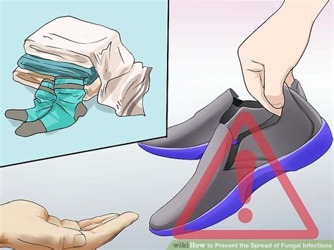 5 ways to prevent the spread of fungal infections wikihow