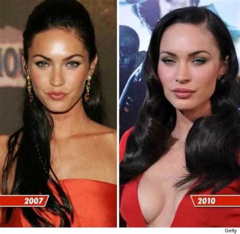 Celebrity Plastic Surgery The Good And The Botched