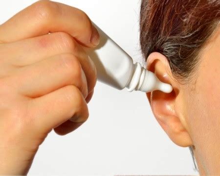 remedies  ear wax buildup thriftyfun
