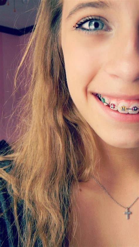 Pin By Angela Tano On Body Braces Cute Braces Girl Brace Face