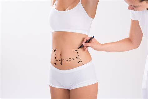 Tummy Tuck Calgary Ab Abdominoplasty Calgary Ab Tummy Tuck Cost