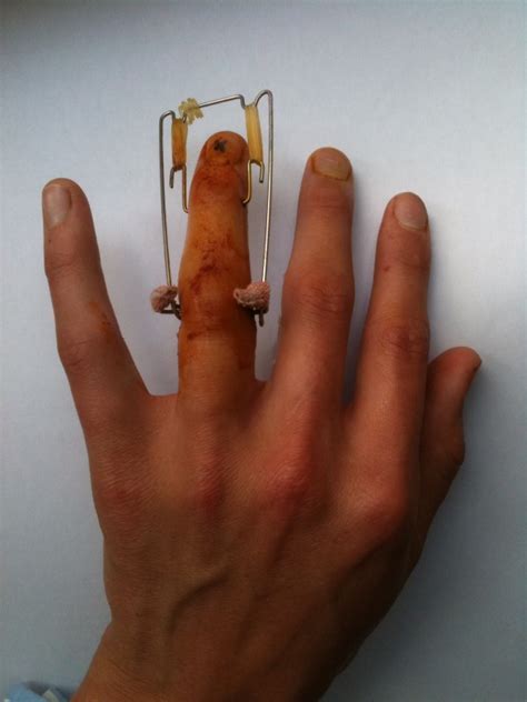 file suzuki frame on a ring finger may 2010 wikimedia commons