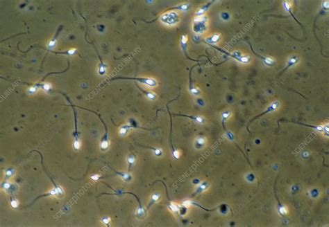 light micrograph of human sperm cells stock image p624 0111