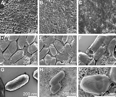 Electron Microscope E Coli Bacteria Micropedia