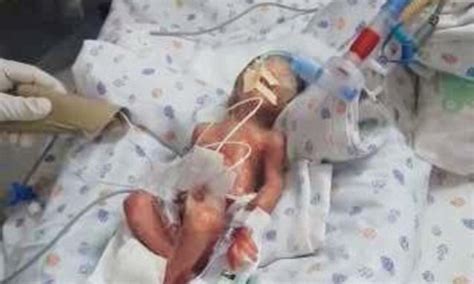 newborn boy incorrectly declared dead  discovered alive daily mail