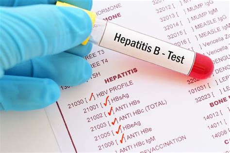 tested  hepatitis bhbv