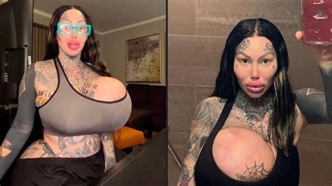 instagram model left with huge uniboob after one of her implants exploded