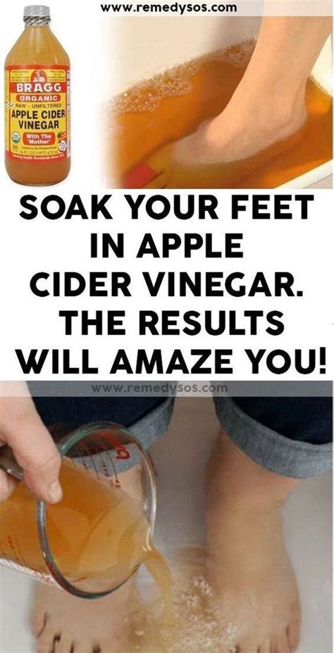 soaking  feet  apple cider vinegar apple cider vinegar