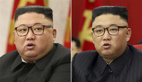 ‘slim Jong Un Kims Weight Loss Raises Questions In North Korea And
