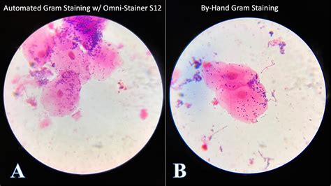 New Automated Gram Staining Protocol Parhelia Biosciences