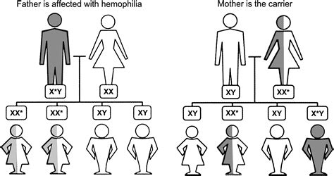 hemophilia is an example of a degenerative disease captions save