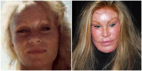 17 Of The Worst Plastic Surgery Fails Do They See What