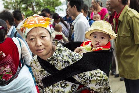 meet  patients wen ting  xiang cui operation smile