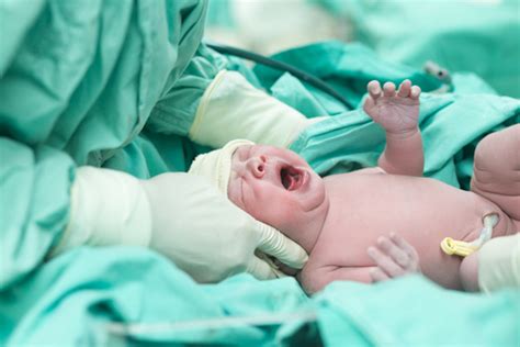 10 birth injuries that can be caused by forceps thurswell law