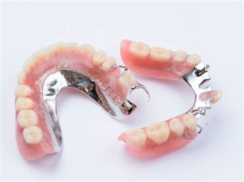 types  dentures  today olds denture implant centre