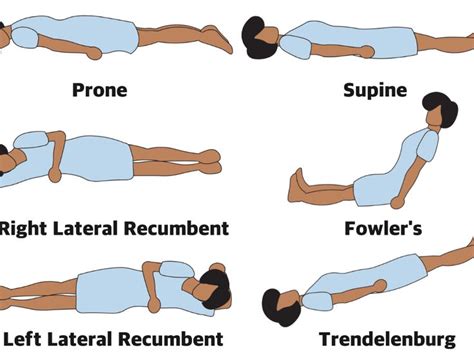 lateral recumbent position google search radiology student