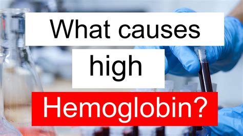 high hemoglobin   ferritin