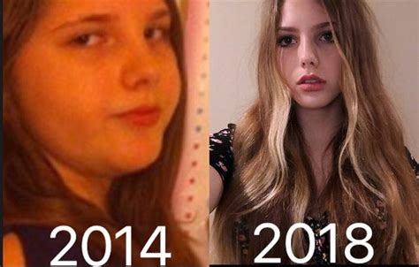 the 18 year old russian girl weighs nearly 100 kg losing weight