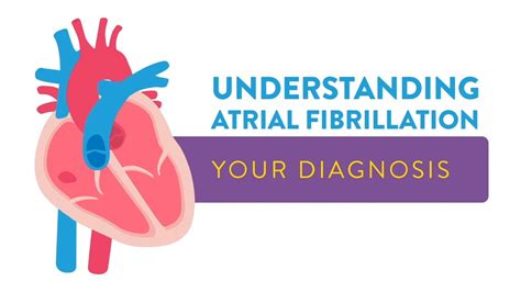 Understanding Atrial Fibrillation Your Diagnosis Youtube