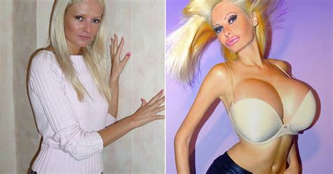 Glamour Model Spends £30k On Plastic Surgery To Look Like