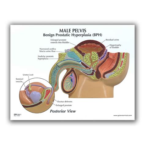 Male Pelvis Bph 3d Model Health Edco Anatomy Models