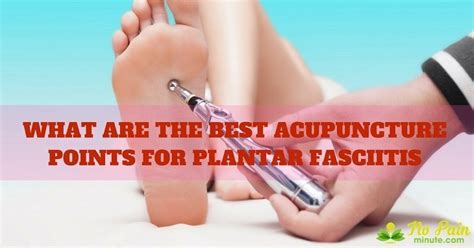 What Are The Best Acupuncture Points For Plantar Fasciitis
