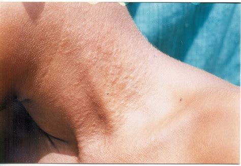 common  dangerous diseases   skin