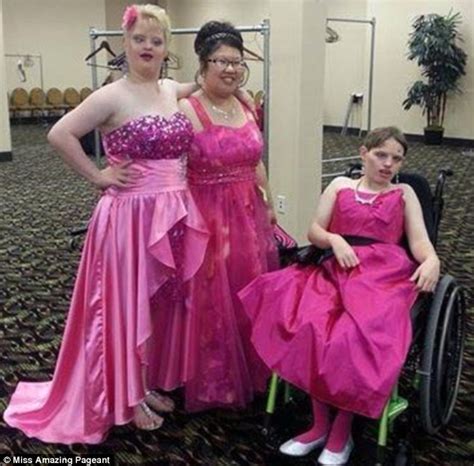 Miss Amazing Pageant Celebrates Girls And Women With Disabilities In