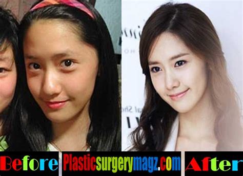 Zhang Yu Xi Plastic Surgery Before And After Celebrity