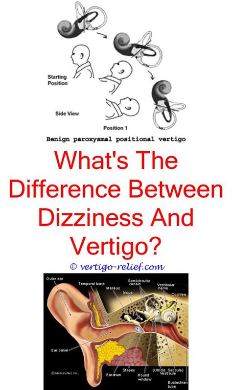 Vertigo Causes And Remedies Vertigo Treatment Vertigo Remedies