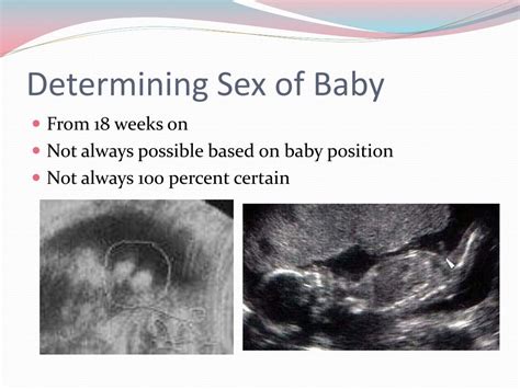 ppt prenatal care and ultrasounds powerpoint presentation free