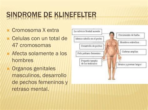 Características Da Síndrome De Klinefelter Edubrainaz