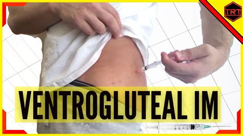 gluteal im injection technique