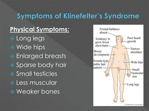 Ppt Klinefelters Syndrome Powerpoint Presentation Free Download