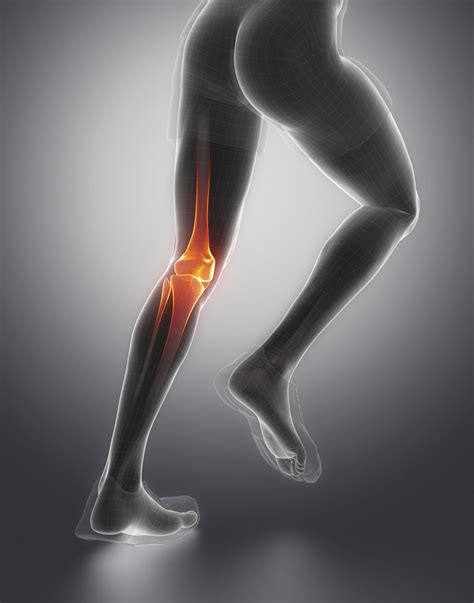 acl injuries   knee capital clinic physiotherapy