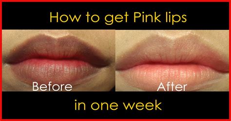 10 proven ways to get rid of dark lips naturally worked for 99