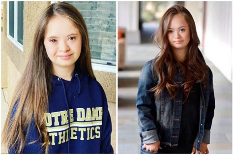 teen model with down s syndrome is breaking stereotypes