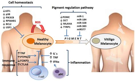 Novel Immunological And Genetic Factors Associated With Vitiligo A Review