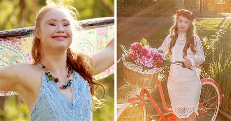 a teen with down syndrome just landed a modelling contract