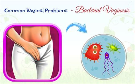 top 15 common vaginal problems that you should know