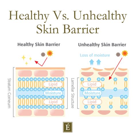 signs  skin barrier  damaged    fix  eminence