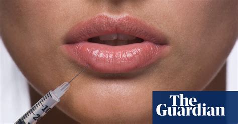 the rise of non surgical beauty ‘my mum said my lip looked like a
