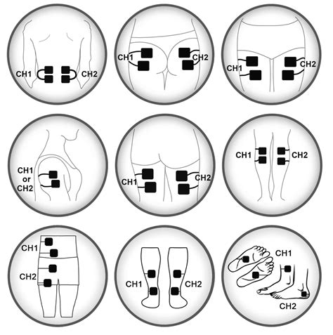 tens electrode placement guide     tens unit  calf pain