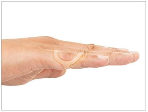mallet finger splint ring how to size a mallet splint
