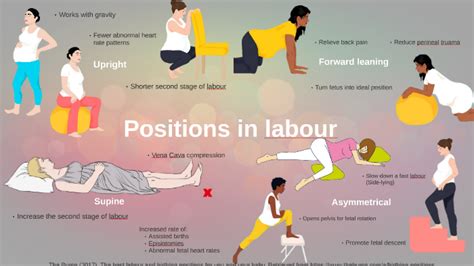 Positions In Labour By Jorja Kirkwood On Prezi